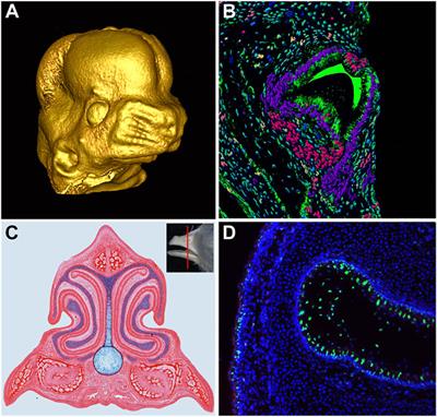 Editorial: Cellular Mechanisms During Normal and Abnormal Craniofacial Development